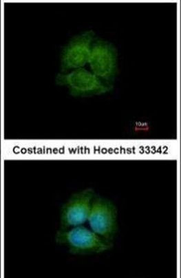 LRRK2 Antibody in Immunocytochemistry (ICC/IF)