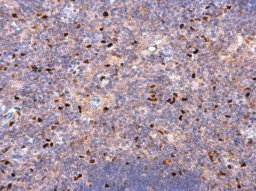 CD86 Antibody in Immunohistochemistry (Paraffin) (IHC (P))