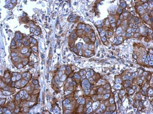 CD11b Antibody in Immunohistochemistry (Paraffin) (IHC (P))