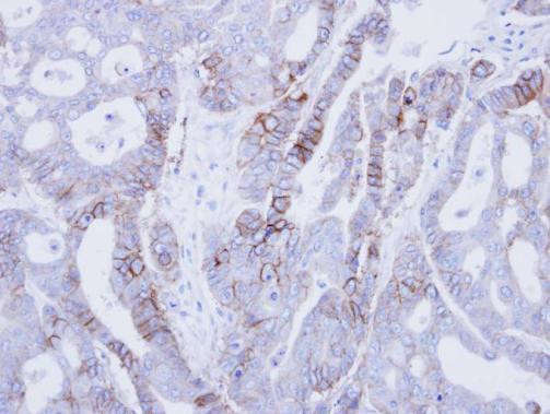 EpCAM Antibody in Immunohistochemistry (Paraffin) (IHC (P))