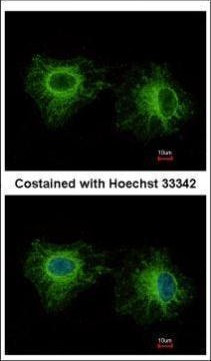 MYL1 Antibody in Immunocytochemistry (ICC/IF)