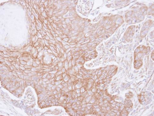 alpha Adducin Antibody in Immunohistochemistry (Paraffin) (IHC (P))