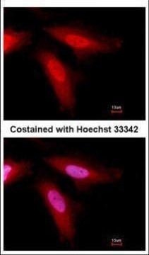 SERPINC1 Antibody in Immunocytochemistry (ICC/IF)