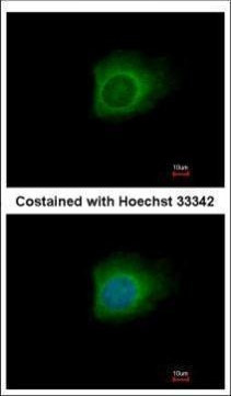 Caspase 10 Antibody in Immunocytochemistry (ICC/IF)