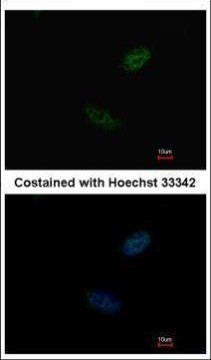 CDX2 Antibody in Immunocytochemistry (ICC/IF)