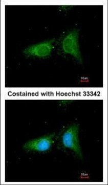 beta COP Antibody in Immunocytochemistry (ICC/IF)