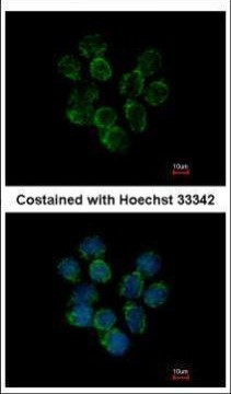 Ceruloplasmin Antibody in Immunocytochemistry (ICC/IF)