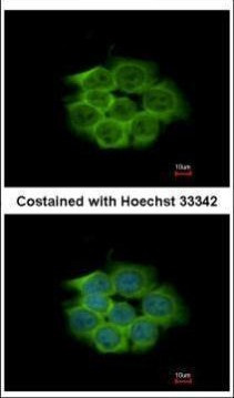 ENO1 Antibody in Immunocytochemistry (ICC/IF)