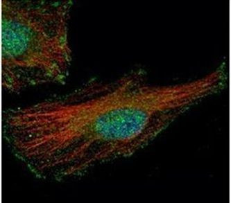FMRP Antibody in Immunocytochemistry (ICC/IF)