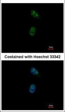 GATA4 Antibody in Immunocytochemistry (ICC/IF)