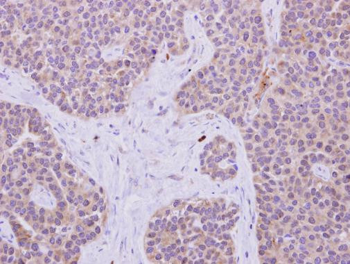 IRS1 Antibody in Immunohistochemistry (Paraffin) (IHC (P))