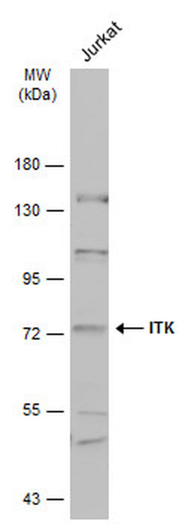 ITK Antibody in Western Blot (WB)
