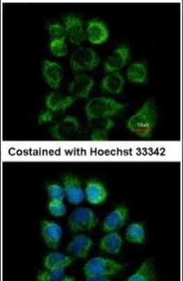 CD46 Antibody in Immunocytochemistry (ICC/IF)