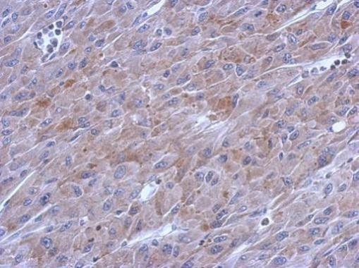 POLG Antibody in Immunohistochemistry (Paraffin) (IHC (P))