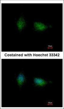 PKC beta Antibody in Immunocytochemistry (ICC/IF)