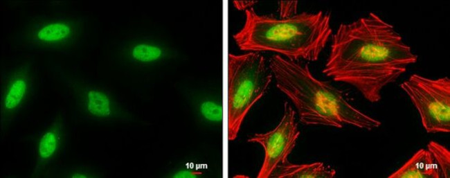 TIA-1 Antibody in Immunocytochemistry (ICC/IF)