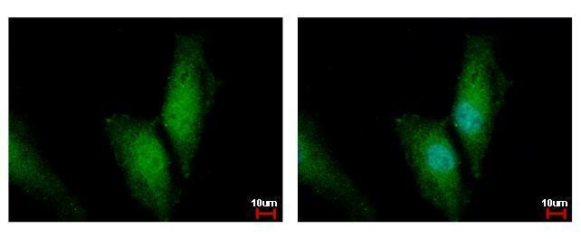 UBC13 Antibody in Immunocytochemistry (ICC/IF)