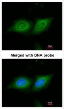 14-3-3 beta Antibody in Immunocytochemistry (ICC/IF)