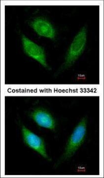 AIF Antibody in Immunocytochemistry (ICC/IF)