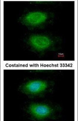 AKT3 Antibody in Immunocytochemistry (ICC/IF)