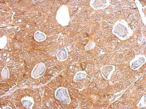 IRAK4 Antibody in Immunohistochemistry (Paraffin) (IHC (P))