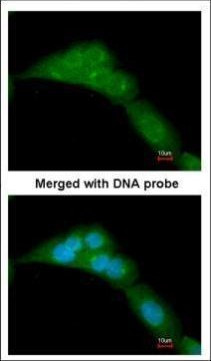 WWOX Antibody in Immunocytochemistry (ICC/IF)