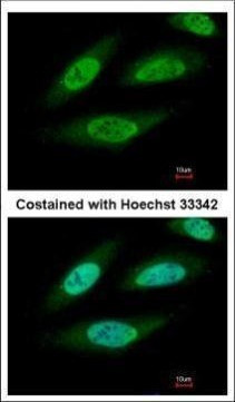 CK2 beta Antibody in Immunocytochemistry (ICC/IF)