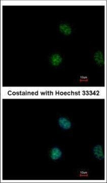 STAT5 alpha Antibody in Immunocytochemistry (ICC/IF)