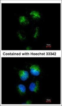 CD99 Antibody in Immunocytochemistry (ICC/IF)