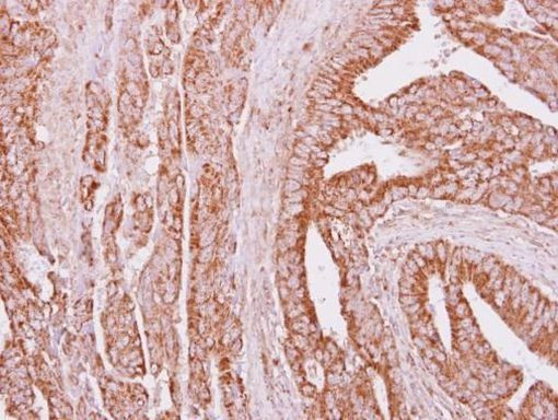 IGFBP3 Antibody in Immunohistochemistry (Paraffin) (IHC (P))