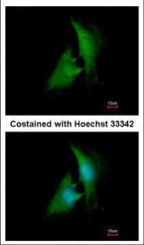 AKR1B1 Antibody in Immunocytochemistry (ICC/IF)