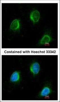 Calpain 3 Antibody in Immunocytochemistry (ICC/IF)