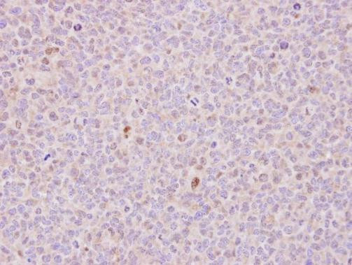 RCC1 Antibody in Immunohistochemistry (Paraffin) (IHC (P))