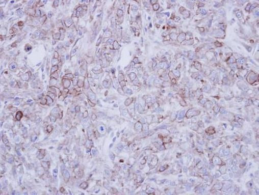 CLCN2 Antibody in Immunohistochemistry (Paraffin) (IHC (P))