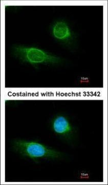 Fibrinogen gamma Antibody in Immunocytochemistry (ICC/IF)