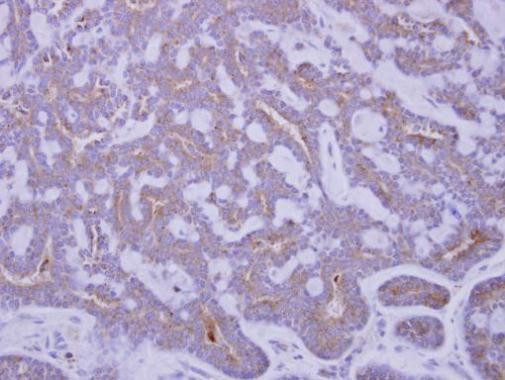 IGFBP2 Antibody in Immunohistochemistry (Paraffin) (IHC (P))