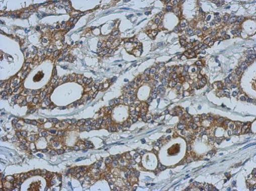 MMP10 Antibody in Immunohistochemistry (Paraffin) (IHC (P))