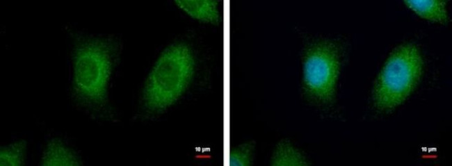 NME3 Antibody in Immunocytochemistry (ICC/IF)