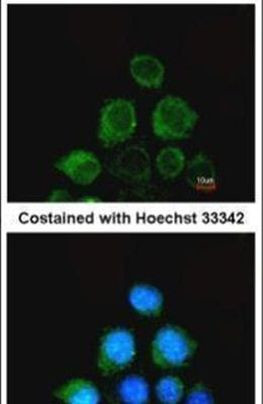 SHP2 Antibody in Immunocytochemistry (ICC/IF)
