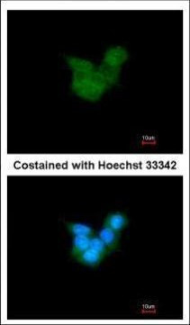 CRALBP Antibody in Immunocytochemistry (ICC/IF)