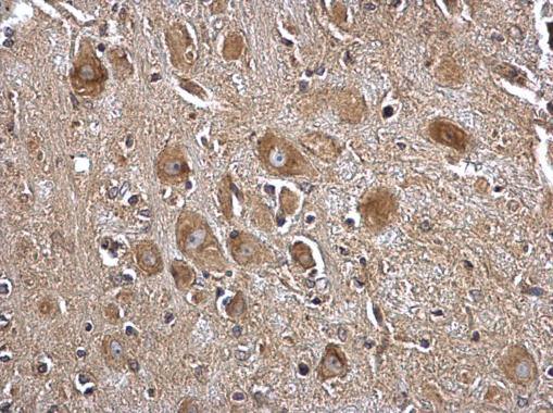 Seryl-tRNA synthetase Antibody in Immunohistochemistry (Paraffin) (IHC (P))