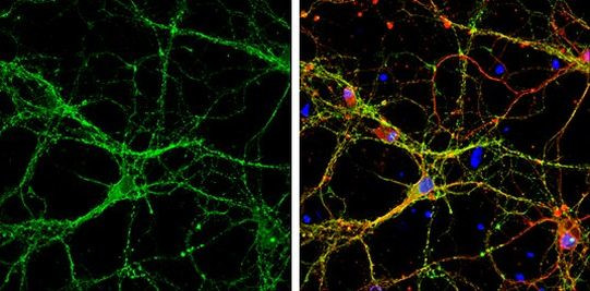 Syntaxin 1 Antibody in Immunocytochemistry (ICC/IF)