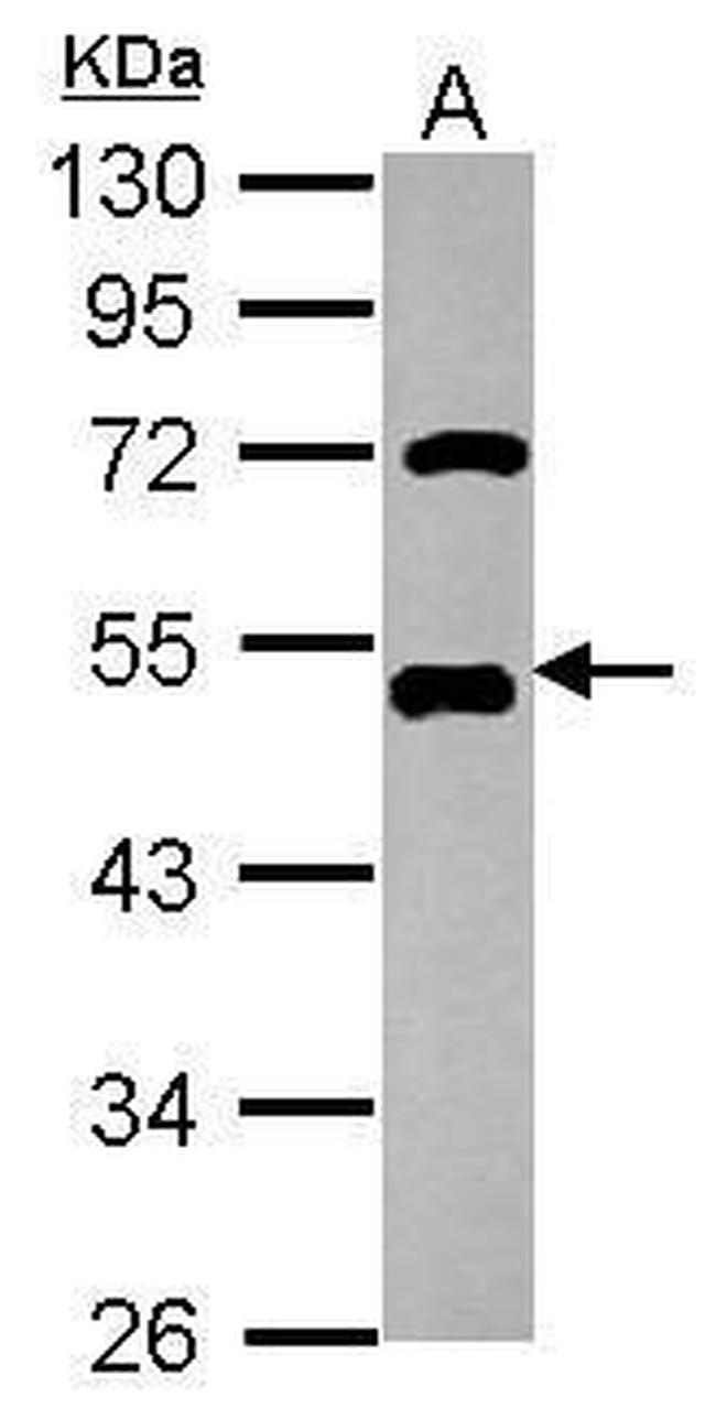 AP2 alpha Antibody in Western Blot (WB)