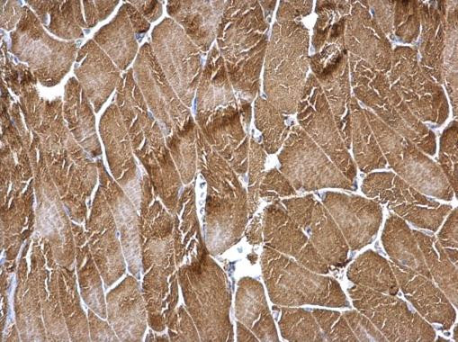 TPM3 Antibody in Immunohistochemistry (Paraffin) (IHC (P))