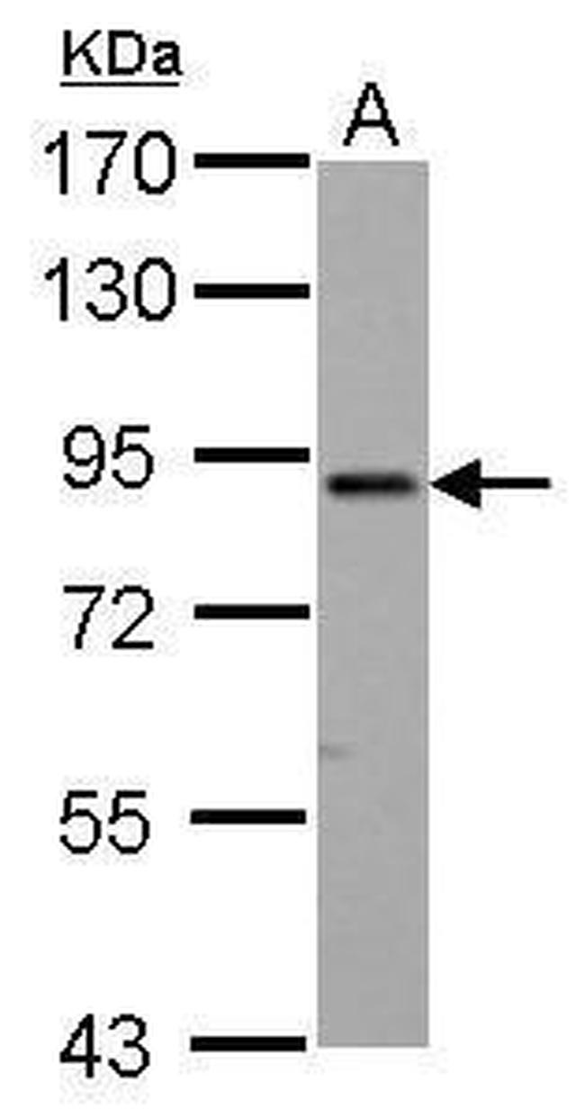 ELMO1 Antibody in Western Blot (WB)
