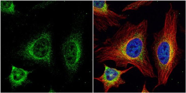 SR-BI Antibody in Immunocytochemistry (ICC/IF)