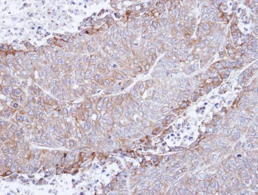 CHRNA4 Antibody in Immunohistochemistry (Paraffin) (IHC (P))