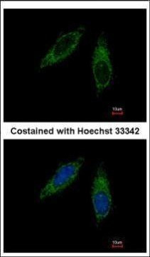CYP2C8 Antibody in Immunocytochemistry (ICC/IF)