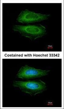 Cortactin Antibody in Immunocytochemistry (ICC/IF)