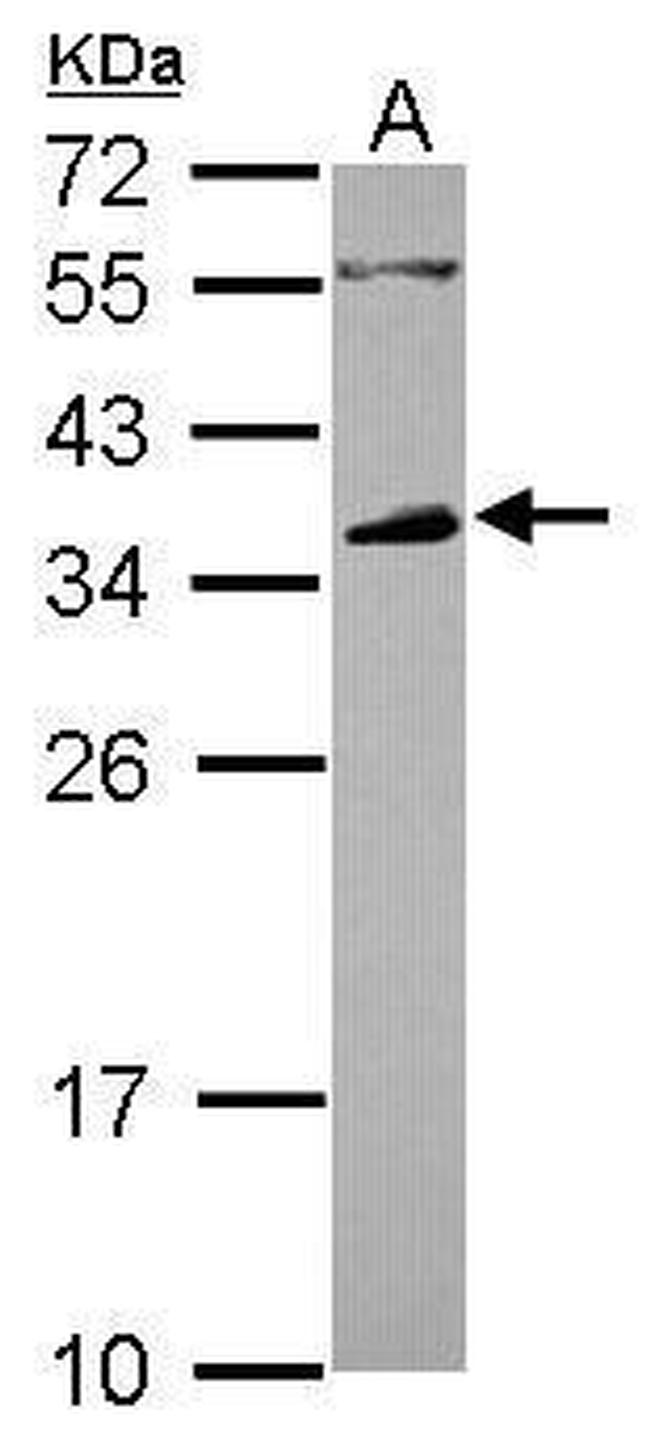 FCGR2B Antibody in Western Blot (WB)